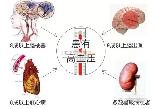 脑得生丸联合降压药对高血压眩晕的影响分析